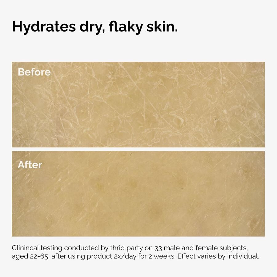 the-body-care-collection-w0 ord-natural-moisturizing-factors-inulin-body-before-after-graphic-02.jpg