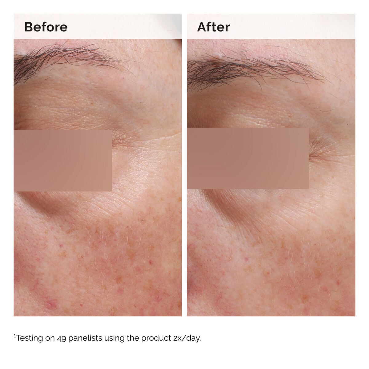 niacinamide-5-face-and-body-emulsion-n1 2024-08-23-ORD-Nia-5pct-Face-Body-B-A-Elasticity-Global-02-1x1.jpg