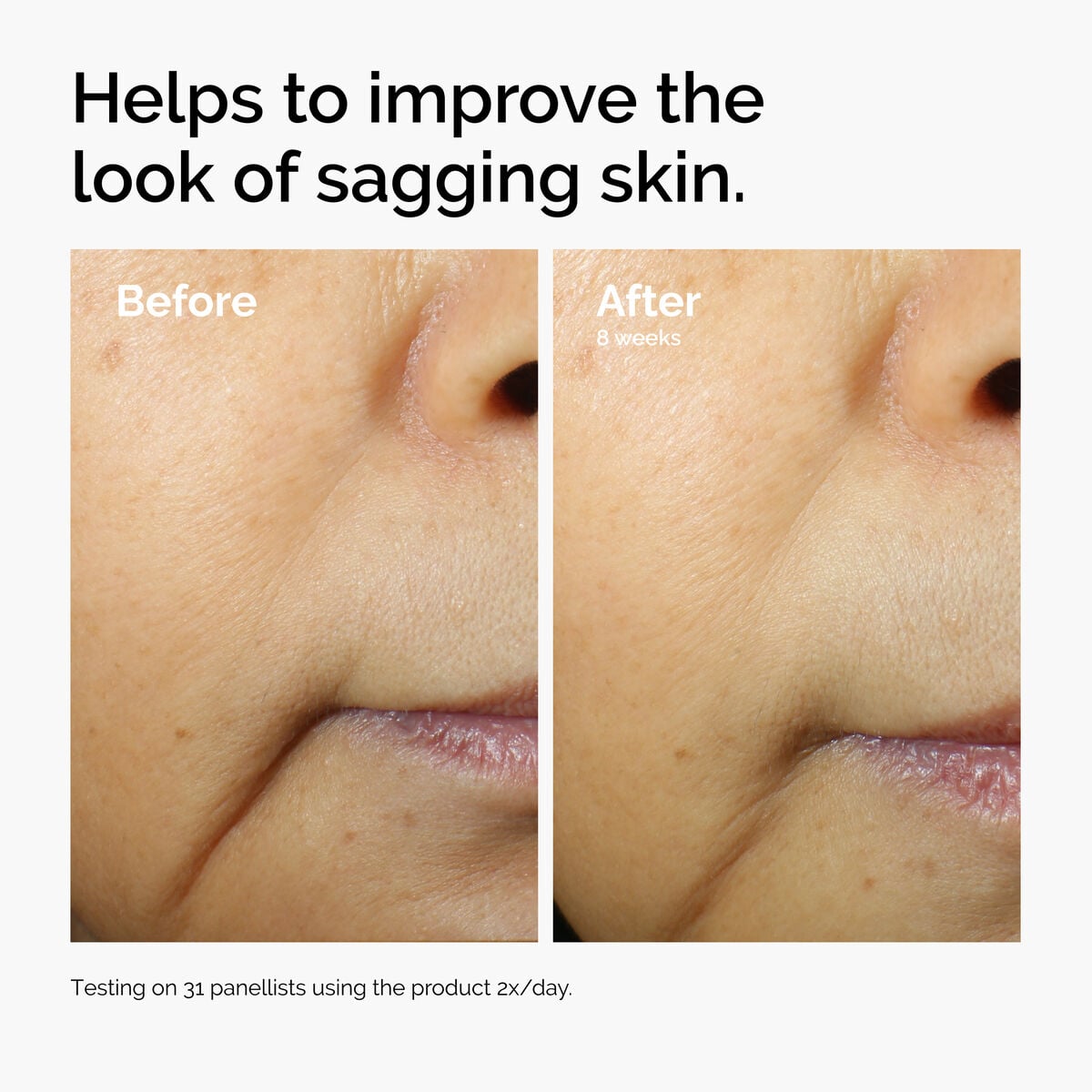 caffeine-3-escin-1-face-serum-f8 ord-caffeine-3pct-escin-1pct-face-serum-before-after-sagging.jpg