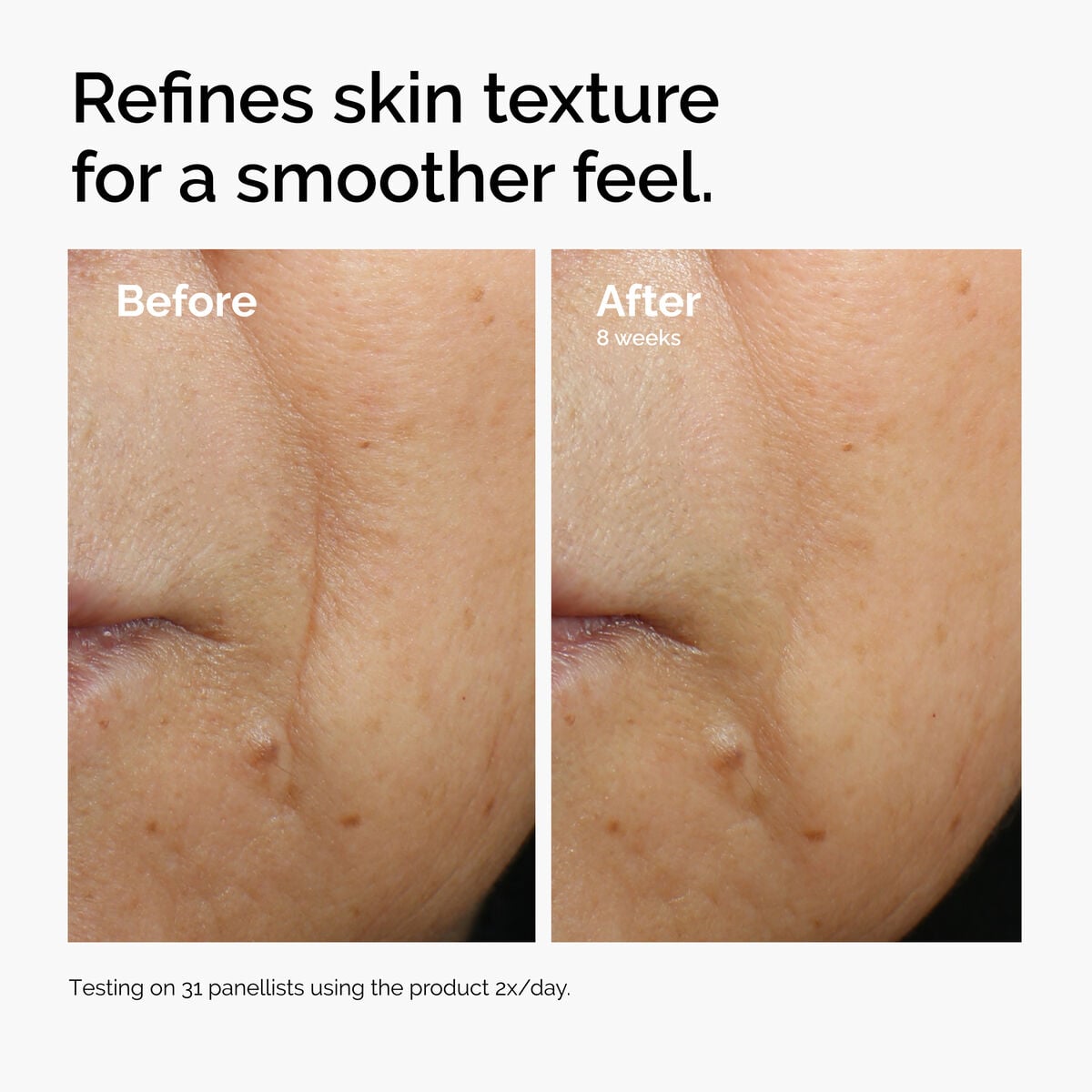 caffeine-3-escin-1-face-serum-f8 ord-caffeine-3pct-escin-1pct-face-serum-before-after-texture.jpg