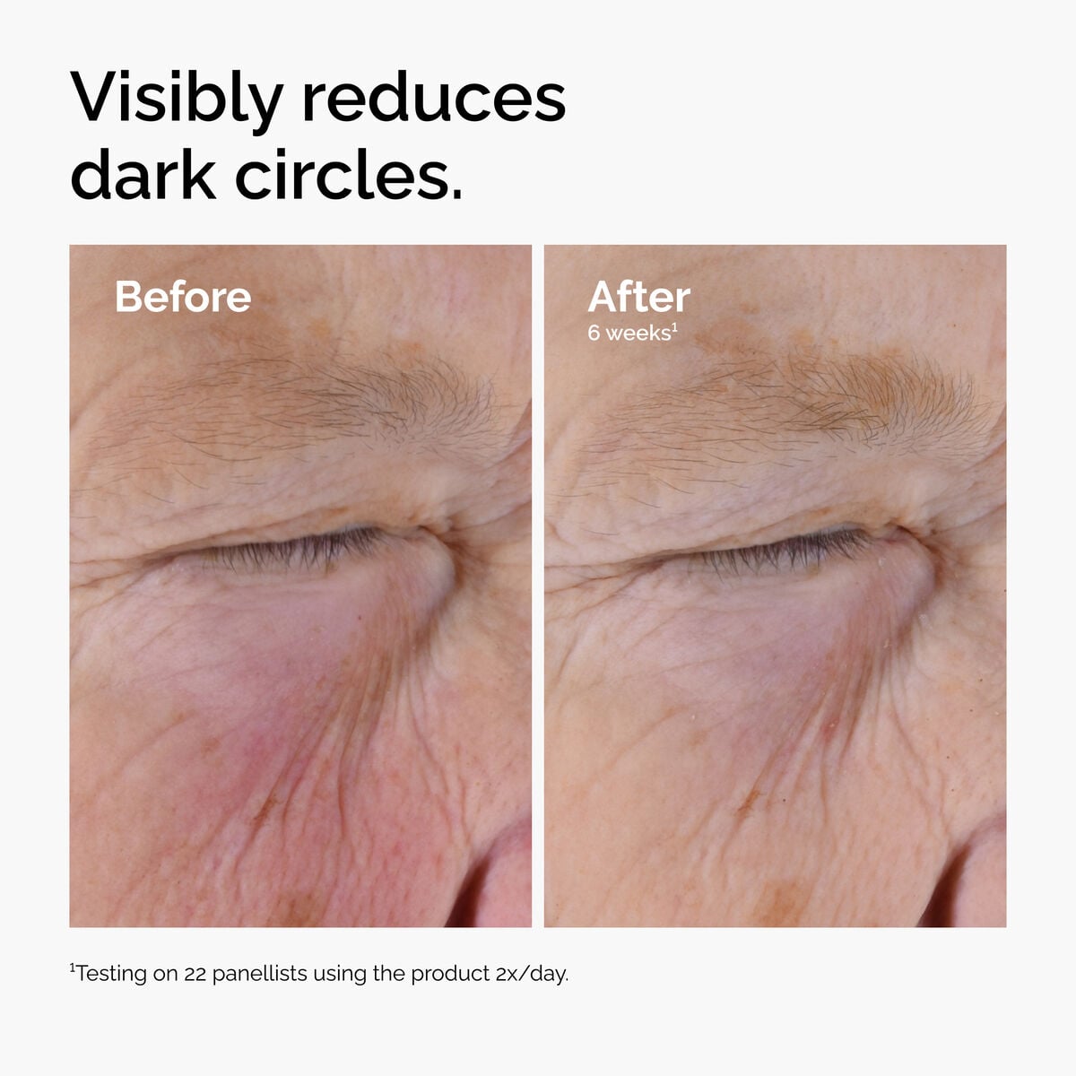 caffeine-solution-5-egcg-eye-serum-a8 ord-caffeine-solution-egcg-dark-circles-before-after.jpg