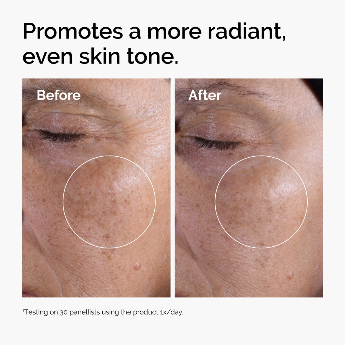 glycolic-acid-7-exfoliating-toner-t5 ord-glycolic-before-after-radiance.jpg