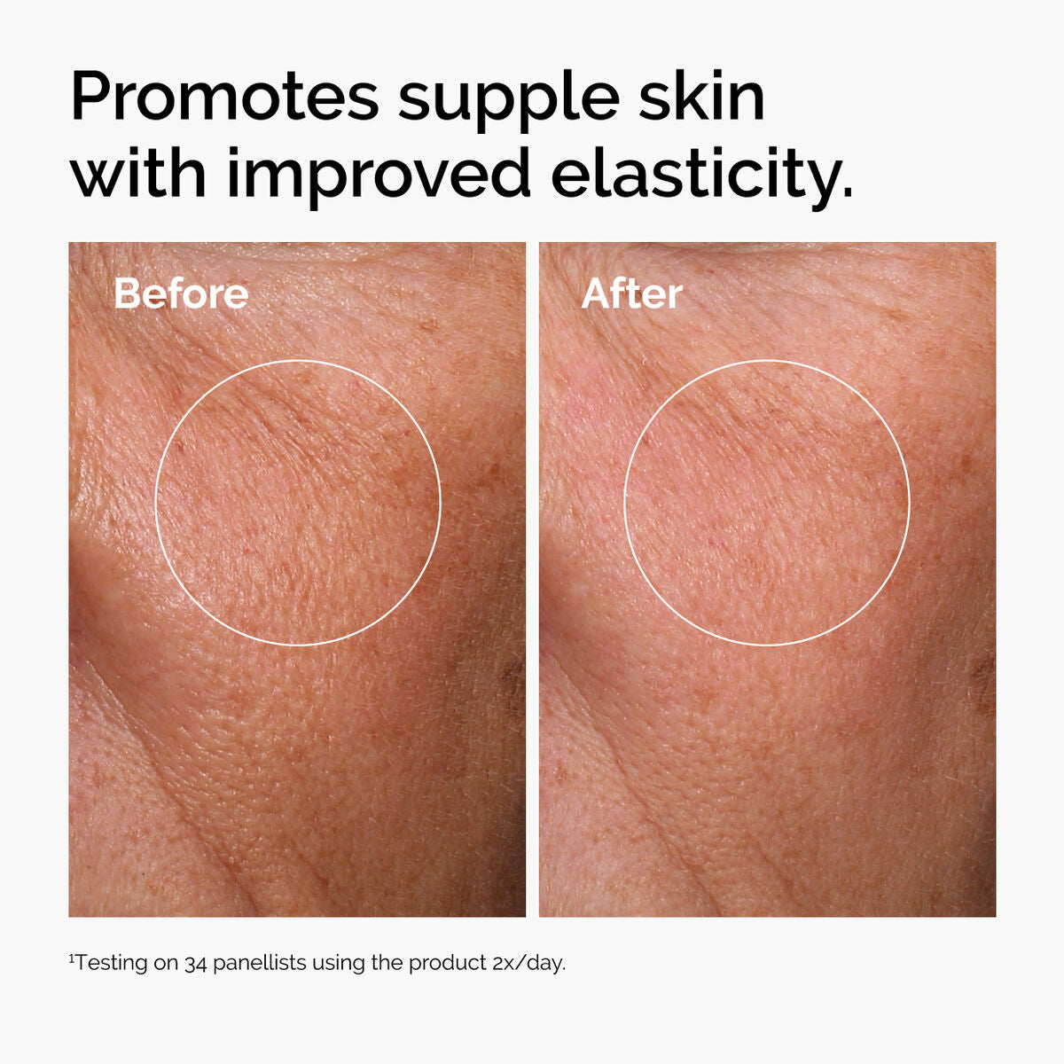 hyaluronic-acid-2-b5-with-ceramides-w3 ord-hyaluronic-acid-2pct-b5-hydrating-serum-before-after-elasticity.jpg