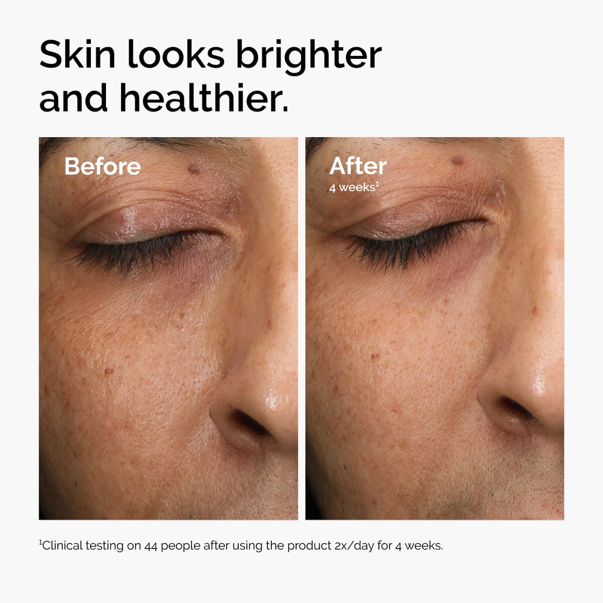 multi-antioxidant-radiance-serum-w8 ord-mars-before-after-healthy.jpg