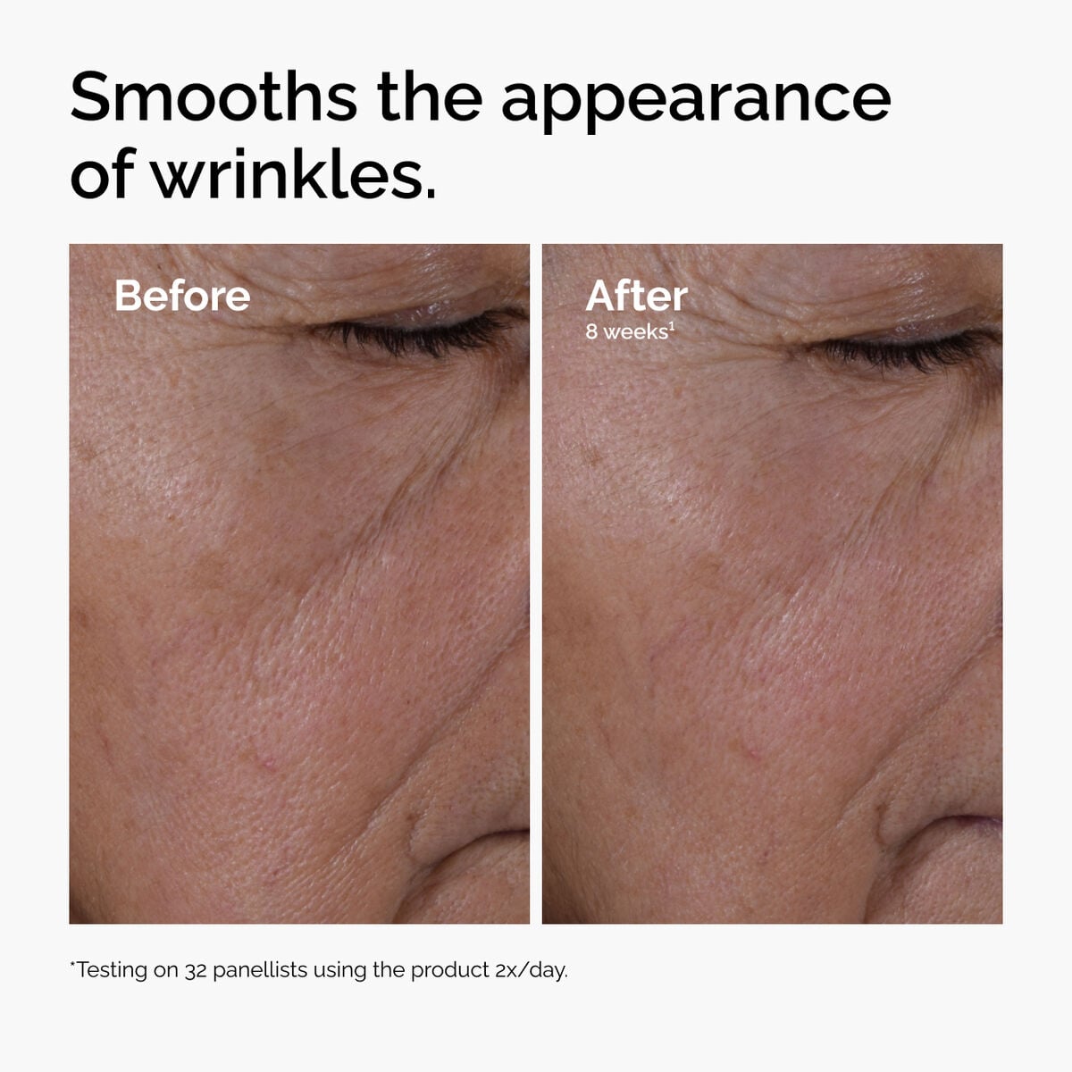 multi-peptide-ha-serum-n8 ord-multi-peptide-ha-serum-wrinkles-before-after.jpg