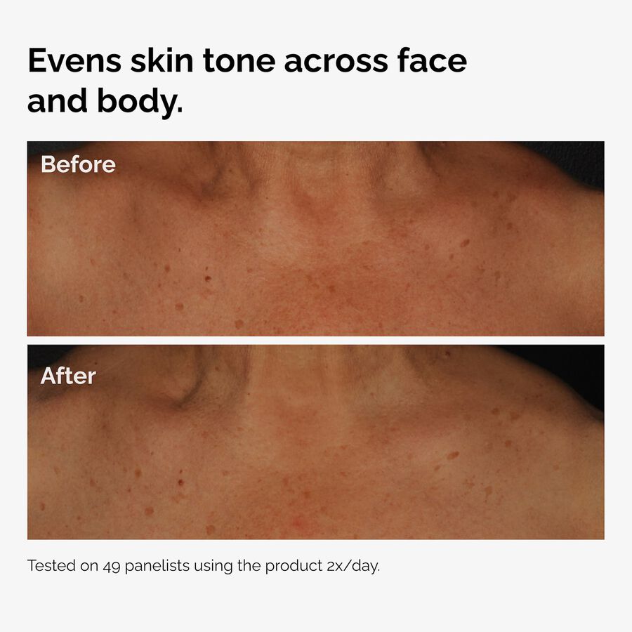 the-body-care-collection-w0 ord-niacinamide-face-body-serum-before-after-even-tone-graphic.jpg