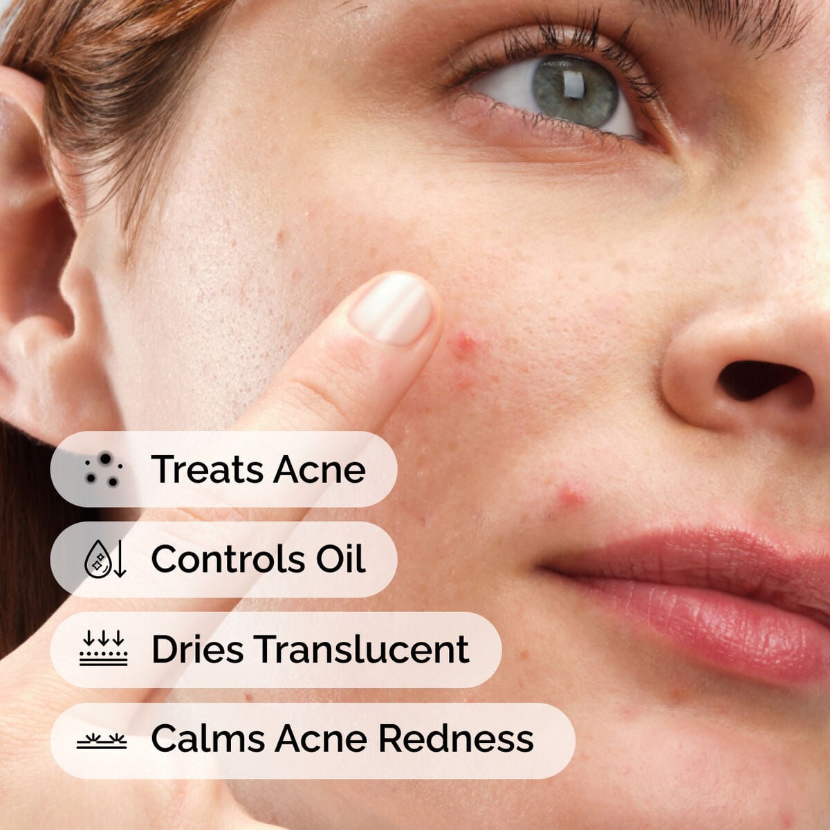 sulfur-10-powder-to-cream-concentrate-h1 ord-sulfur-10pct-powder-to-cream-concentrate-model-application-with-benefits-acne.jpg